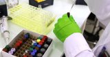 Algérie : ouverture de la première clinique de thérapie cellulaire du pays