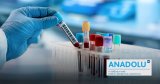 Les 6 tests essentiels pour un diagnostic précoce du cancer